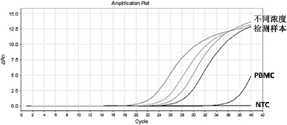 Kit for detecting TSHR (thyroid stimulating hormone receptor) gene mRNA expression through fluorescence quantitation RT-PCR (real-time polymerase chain reaction) and use method of kit