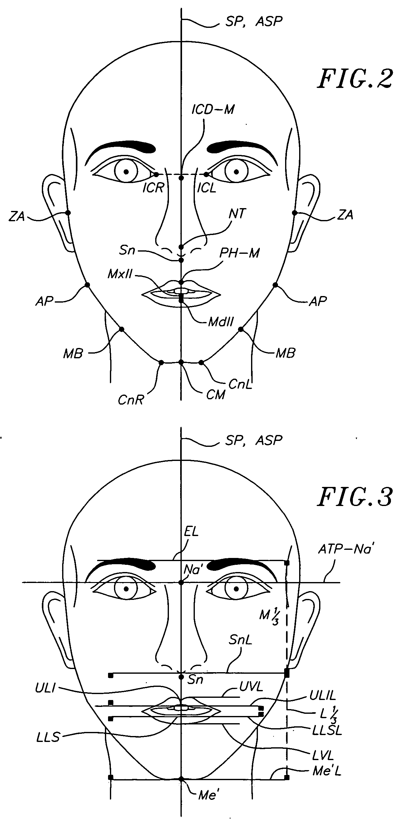 Method for determining and measuring frontal head posture and frontal view thereof