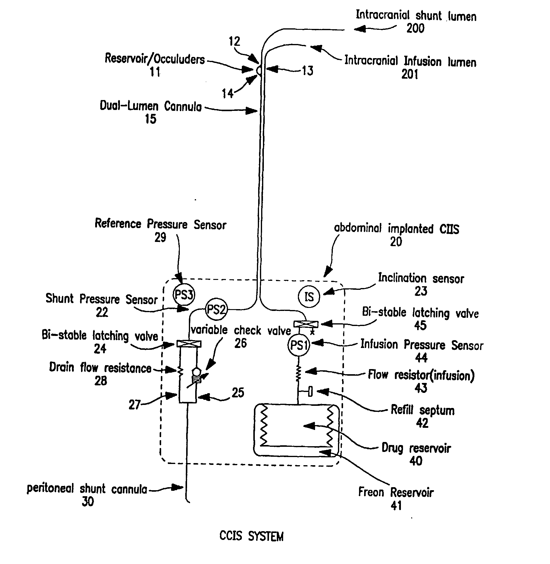 Controlled cerebrospinal infusion and shunt system