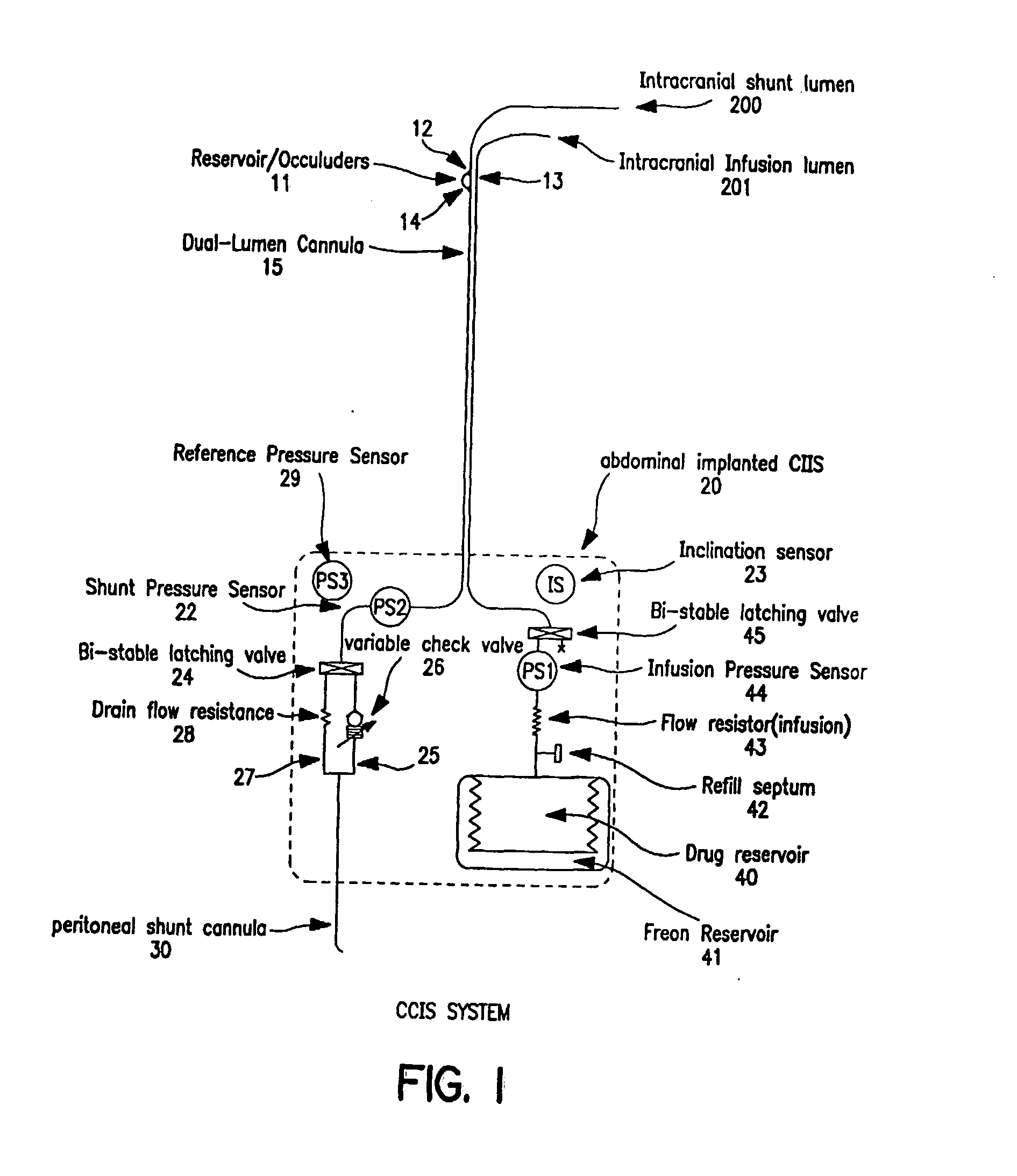 Controlled cerebrospinal infusion and shunt system