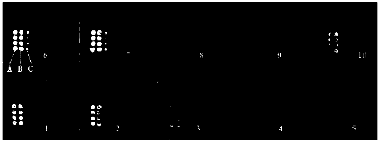 Chemiluminescent protein chip, kit and detection method for detecting serum glycoprotein fucose index