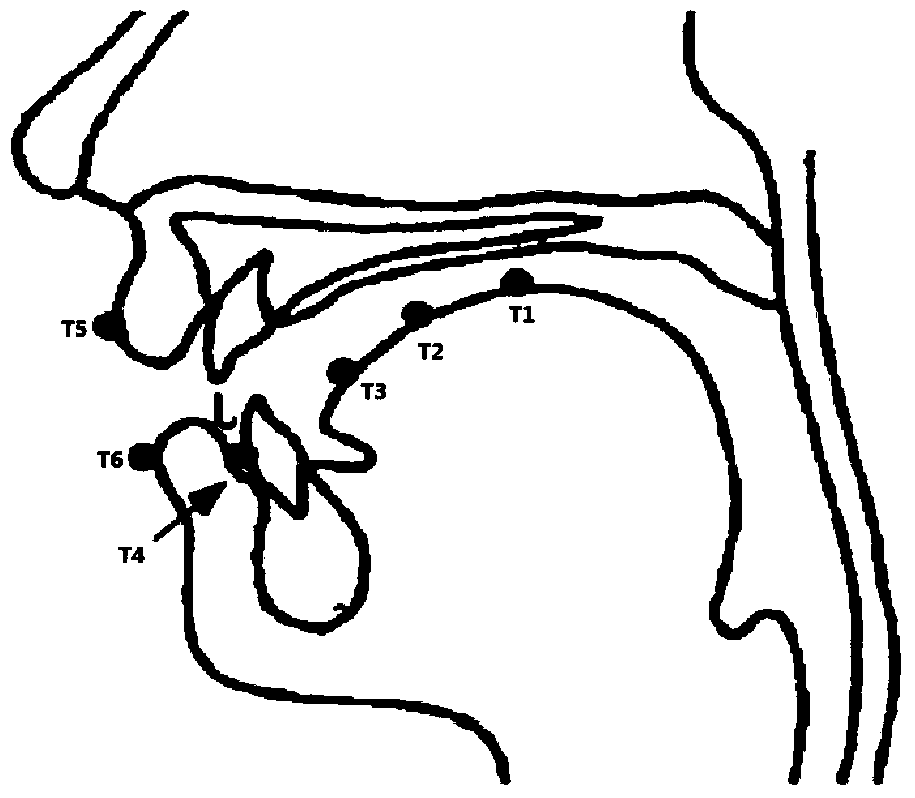 Dysarthria detection method and system