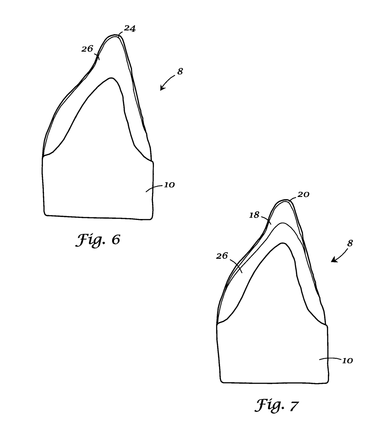 Integrated porcelain system for a dental prosthesis