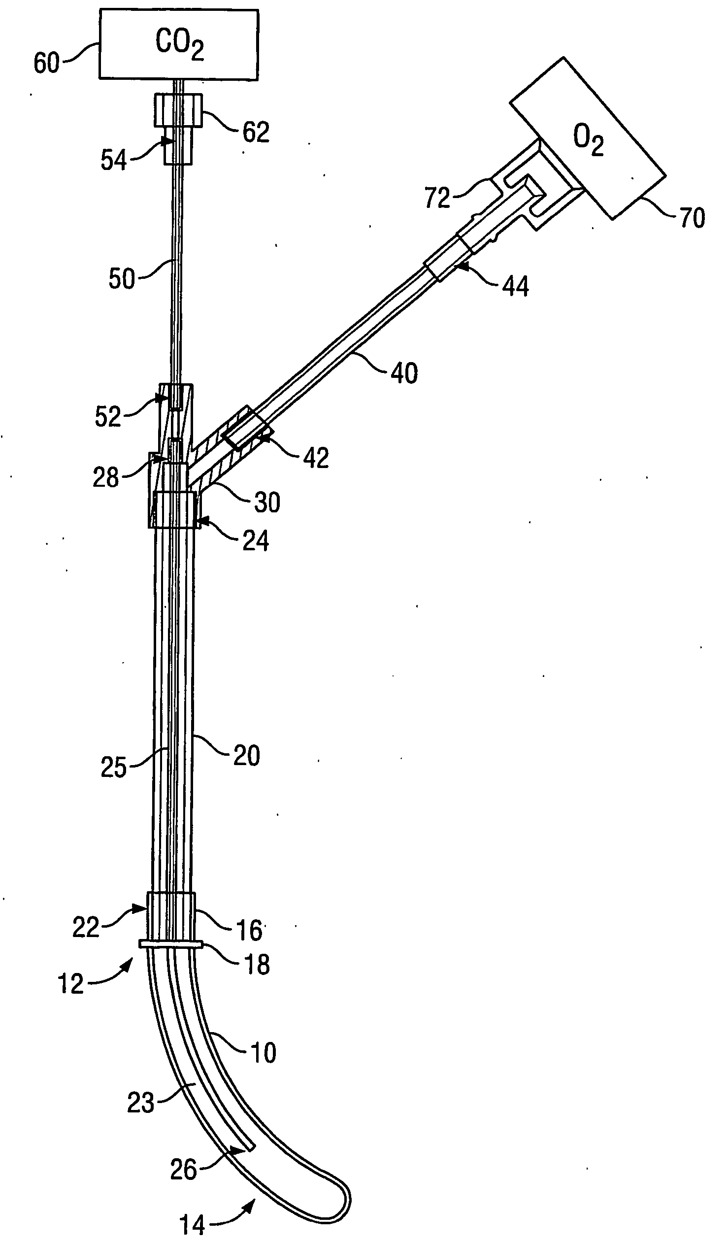 Method and Apparatus for Transnasal Ventilation