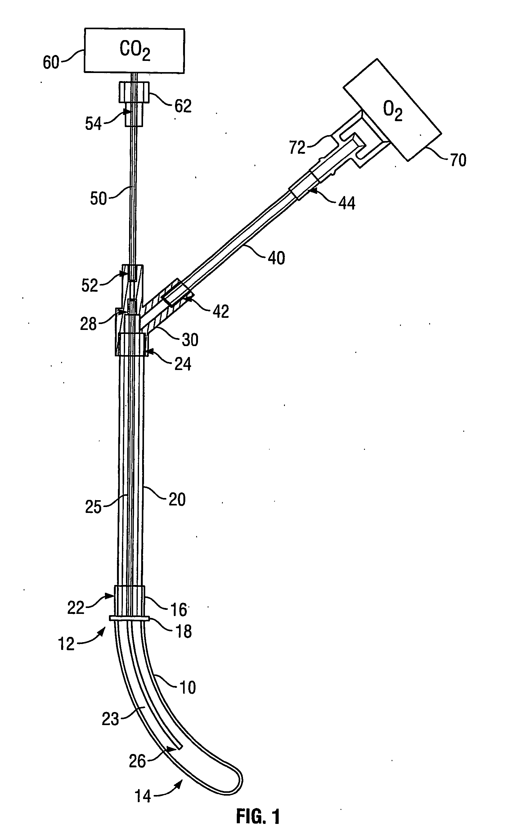 Method and Apparatus for Transnasal Ventilation