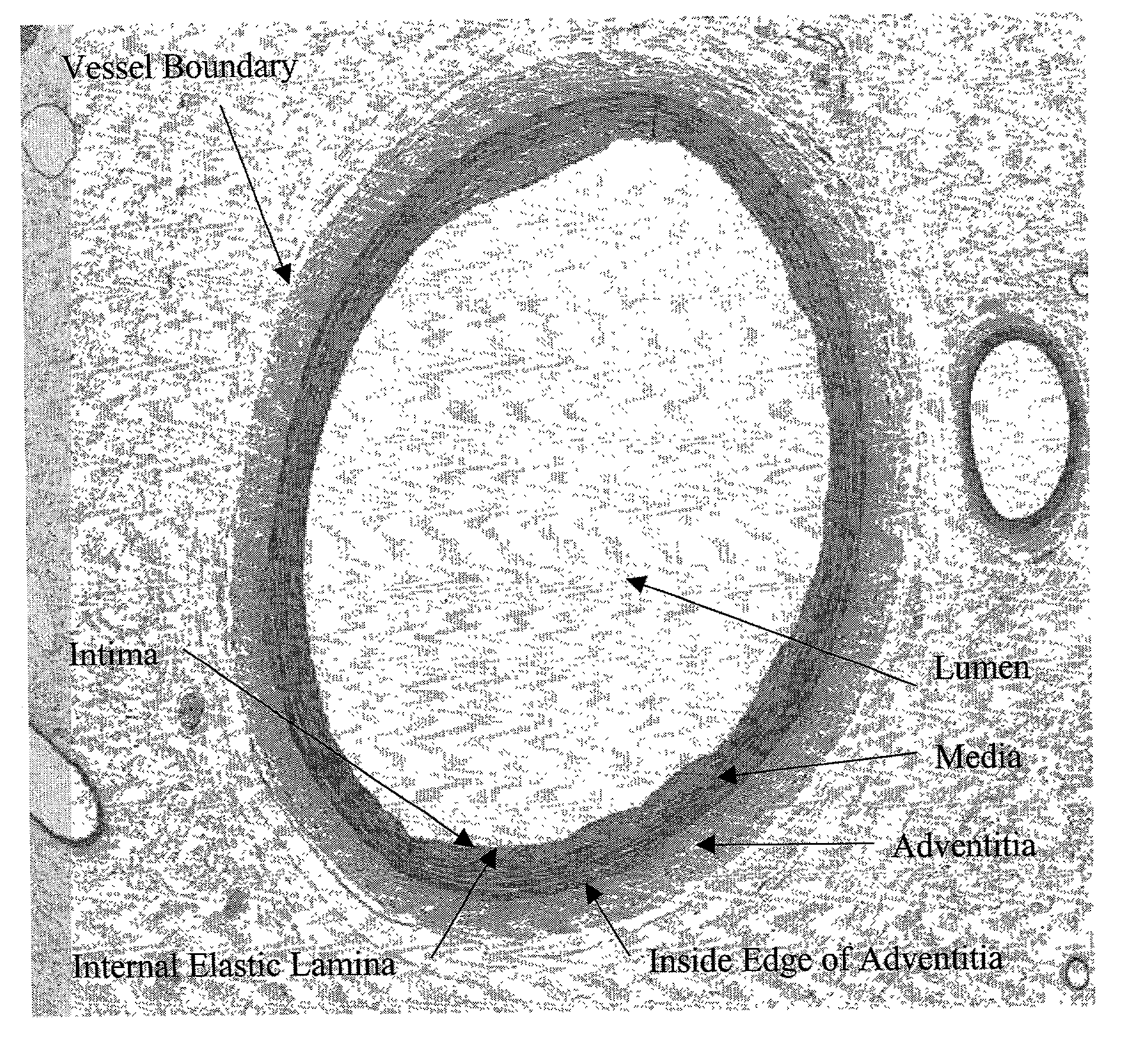 Method for quantitative analysis of blood vessel structure