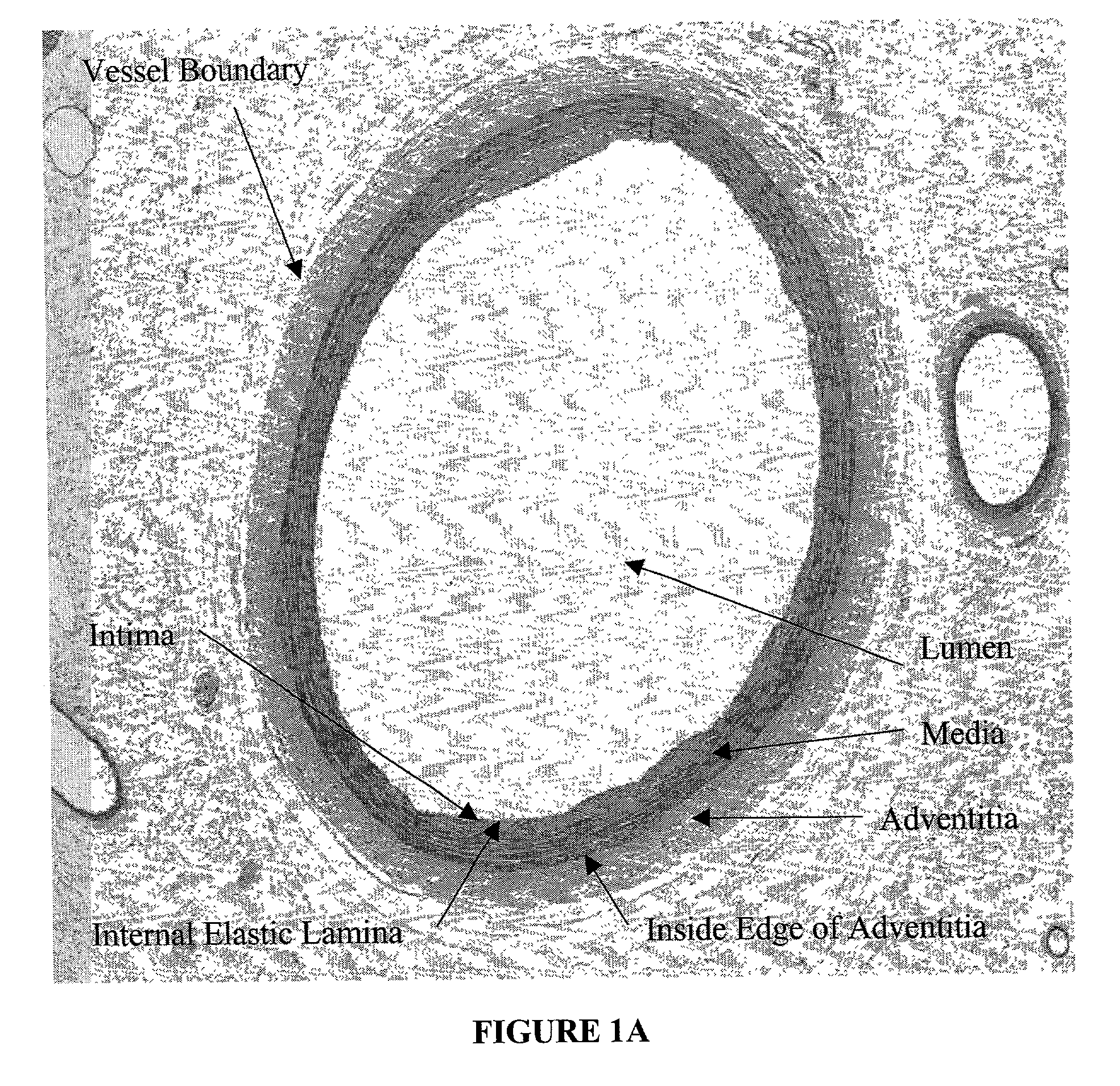 Method for quantitative analysis of blood vessel structure