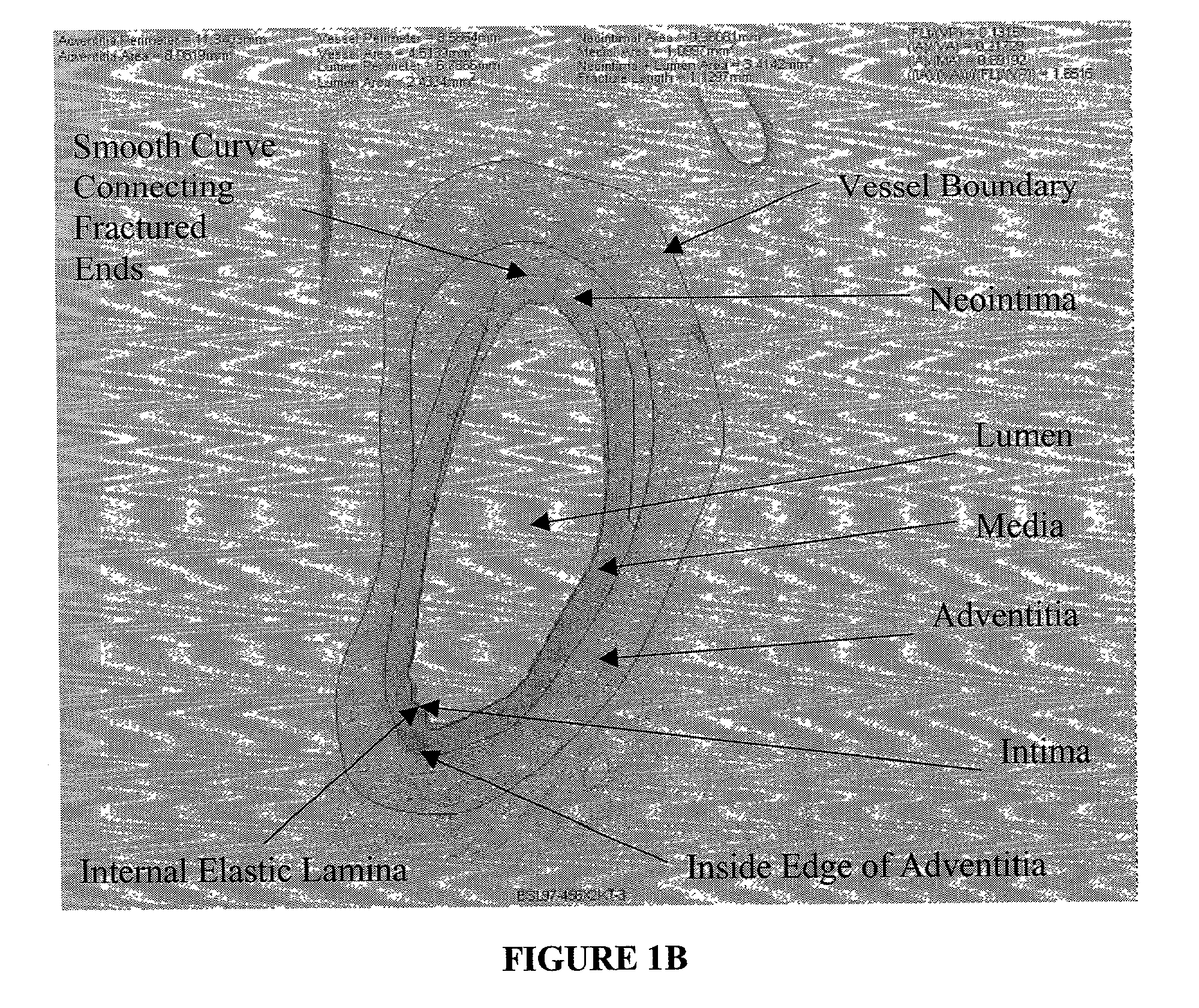 Method for quantitative analysis of blood vessel structure