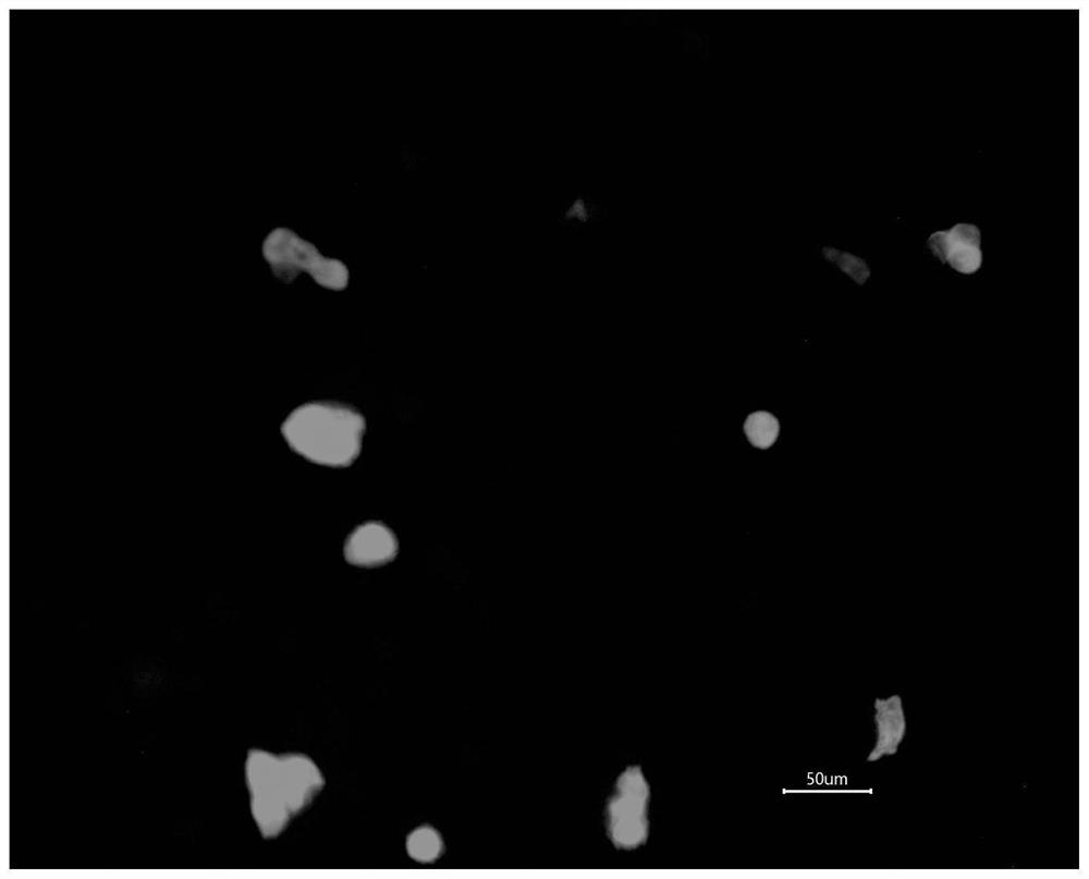 An anti-infection electrospinning degradable hernia prosthesis and preparation method thereof