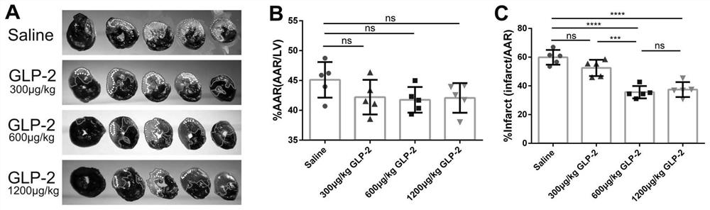 Application of teduglutide in preparation of medicine for treating myocardial ischemia reperfusion injury