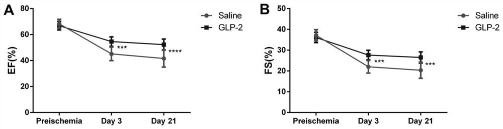 Application of teduglutide in preparation of medicine for treating myocardial ischemia reperfusion injury