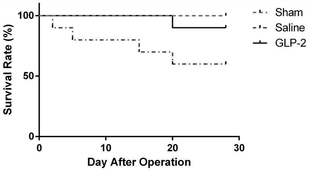 Application of teduglutide in preparation of medicine for treating myocardial ischemia reperfusion injury