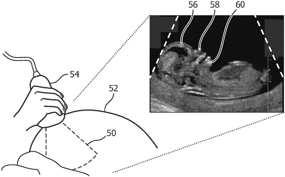 Imaging systems and methods for positioning a 3d ultrasound volume in a desired orientation