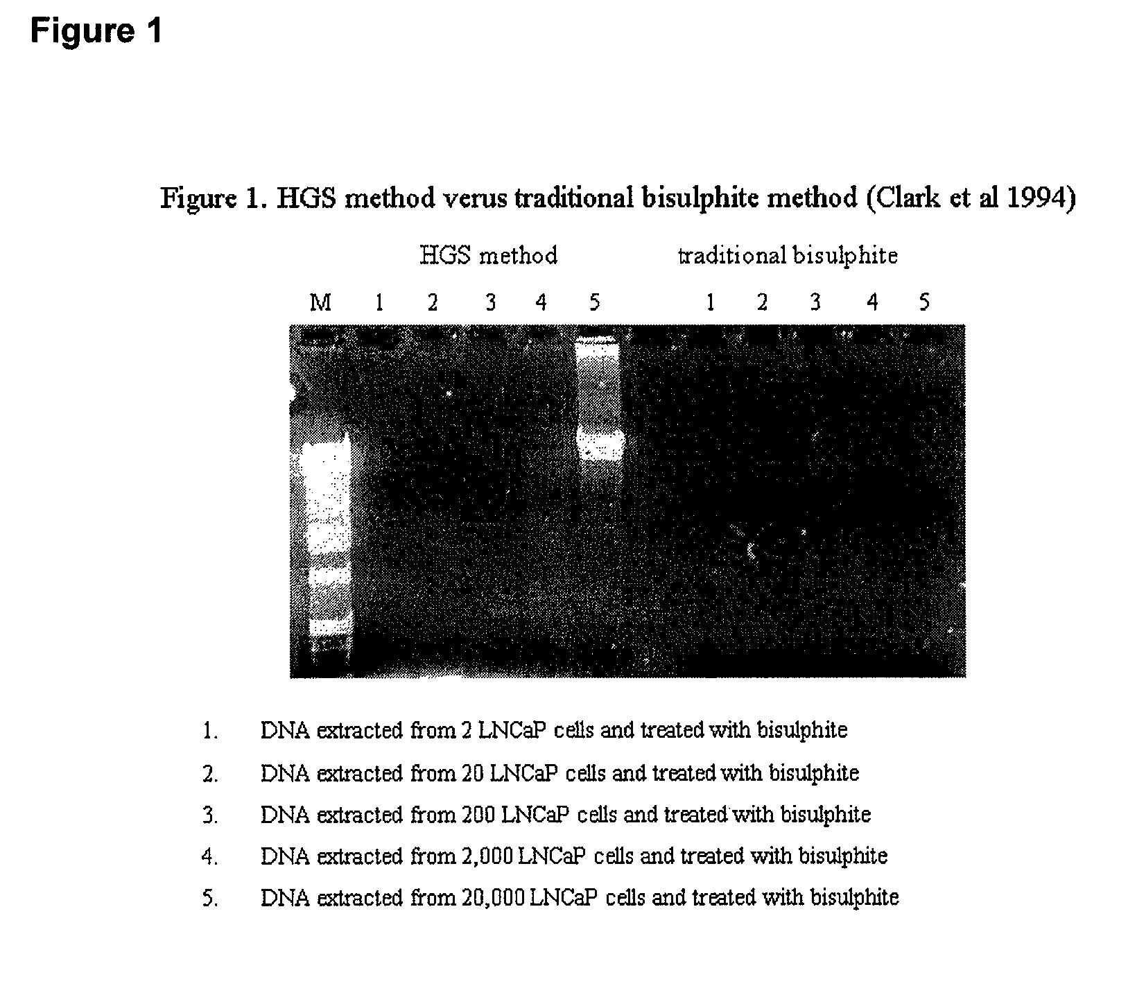 Bisulphite reagent treatment of nucleic acid