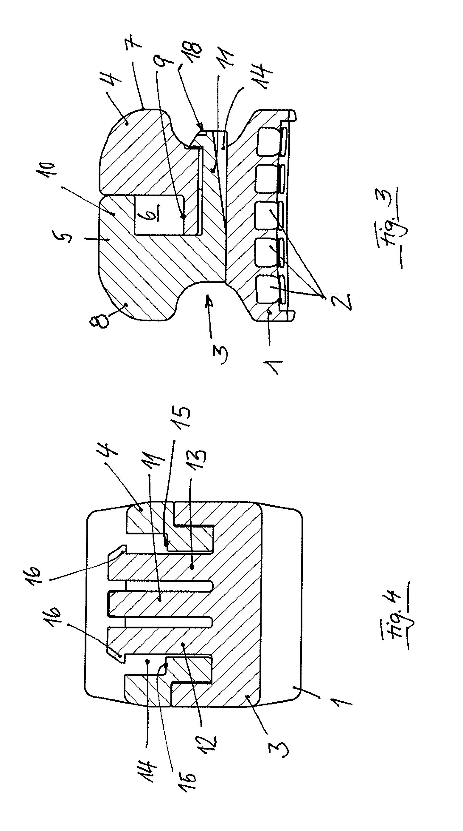 Self-Ligating Bracket for Orthodontics