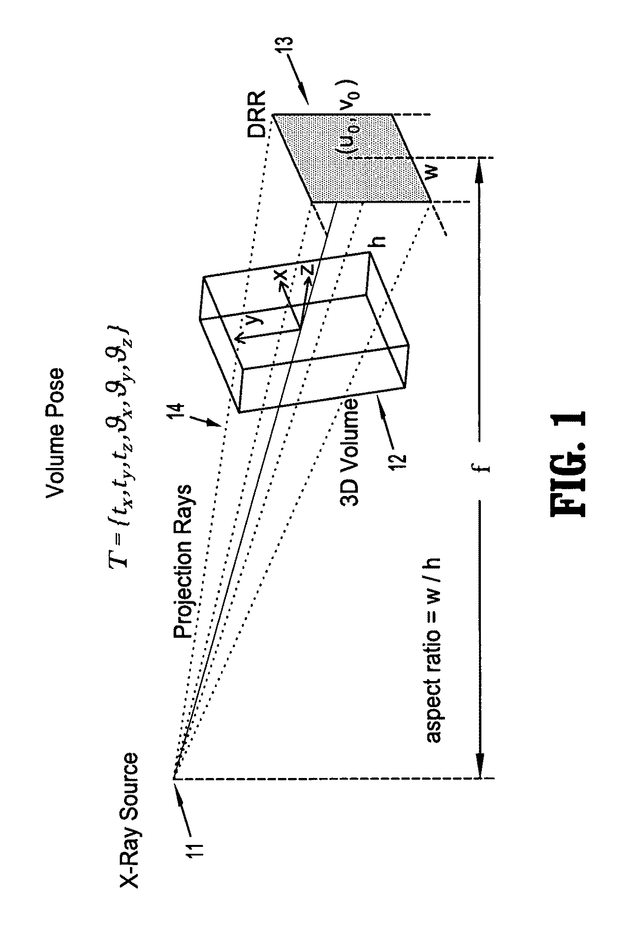 System and method for learning-based 2D/3D rigid registration for image-guided surgery using Jensen-Shannon divergence