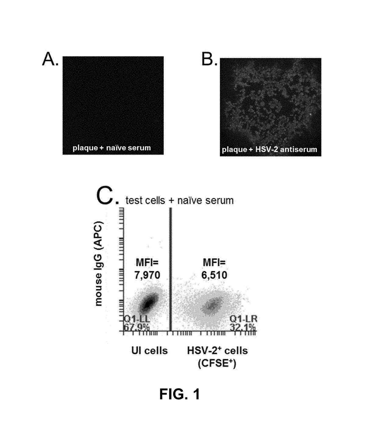 Rapid and sensitive serological assay to determine if patients are infected with herpes simplex virus type 1 HSV-1 and/or type 2 HSV-2