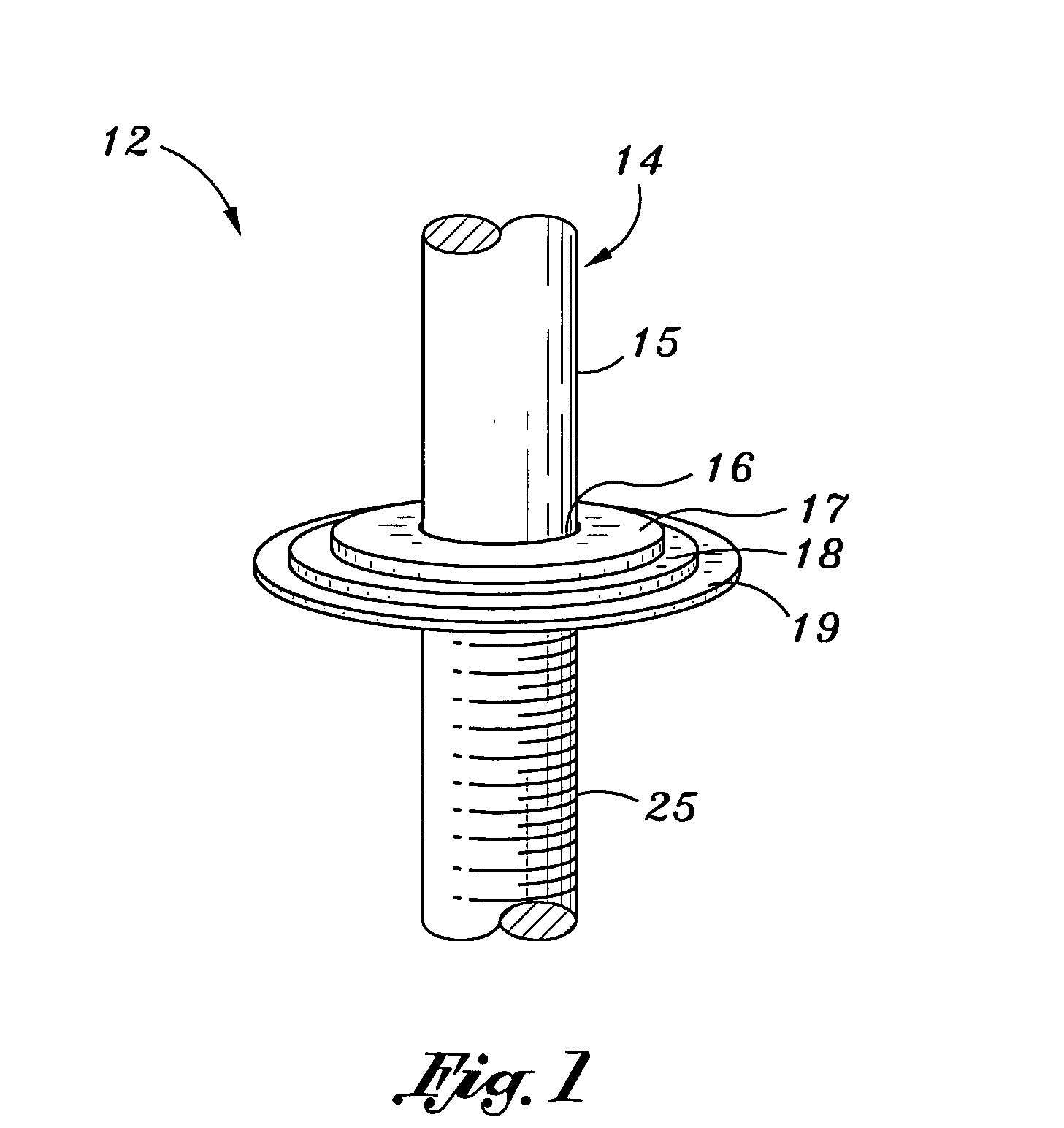 Laminar skin-bone fixation transcutaneous implant and method for use thereof