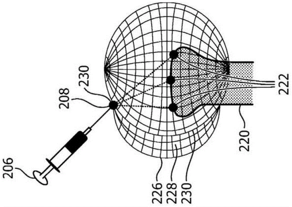 3D Needle Localization Using 2D Imaging Probes