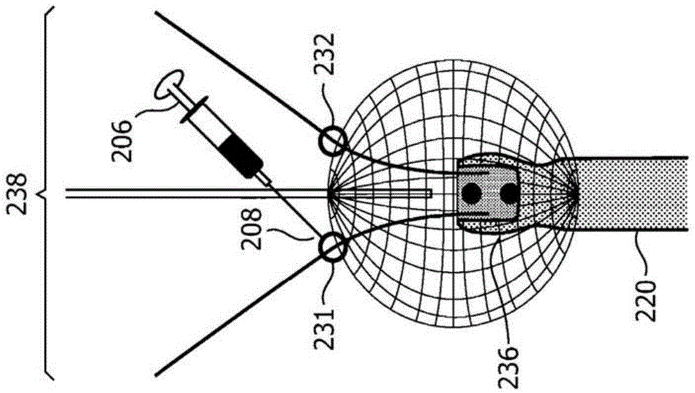 3D Needle Localization Using 2D Imaging Probes