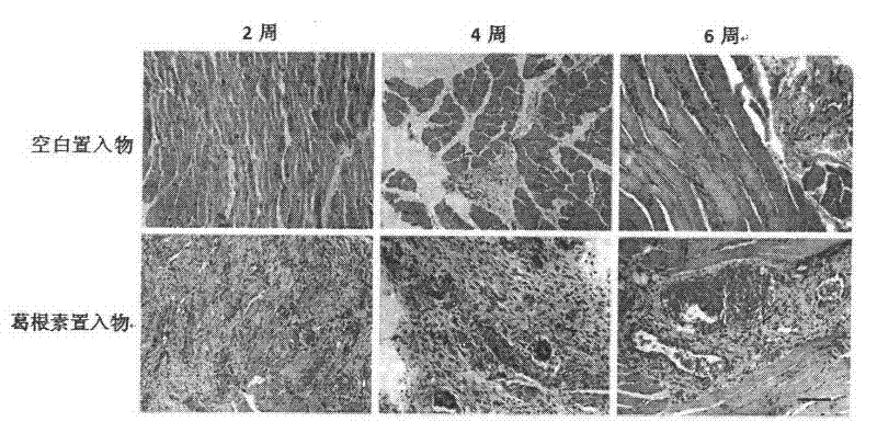 Biodegradable Traditional Chinese Medicine Sustained-release Insert and Preparation for Ischemic Revascularization of Lower Limbs