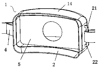 Anti-splashing shield used during oral cavity treatment