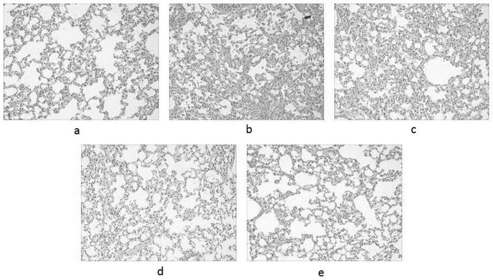 Application of Honeysuckle Petroleum Ether Extract in the Preparation of Drugs for Treating Pulmonary Fibrosis