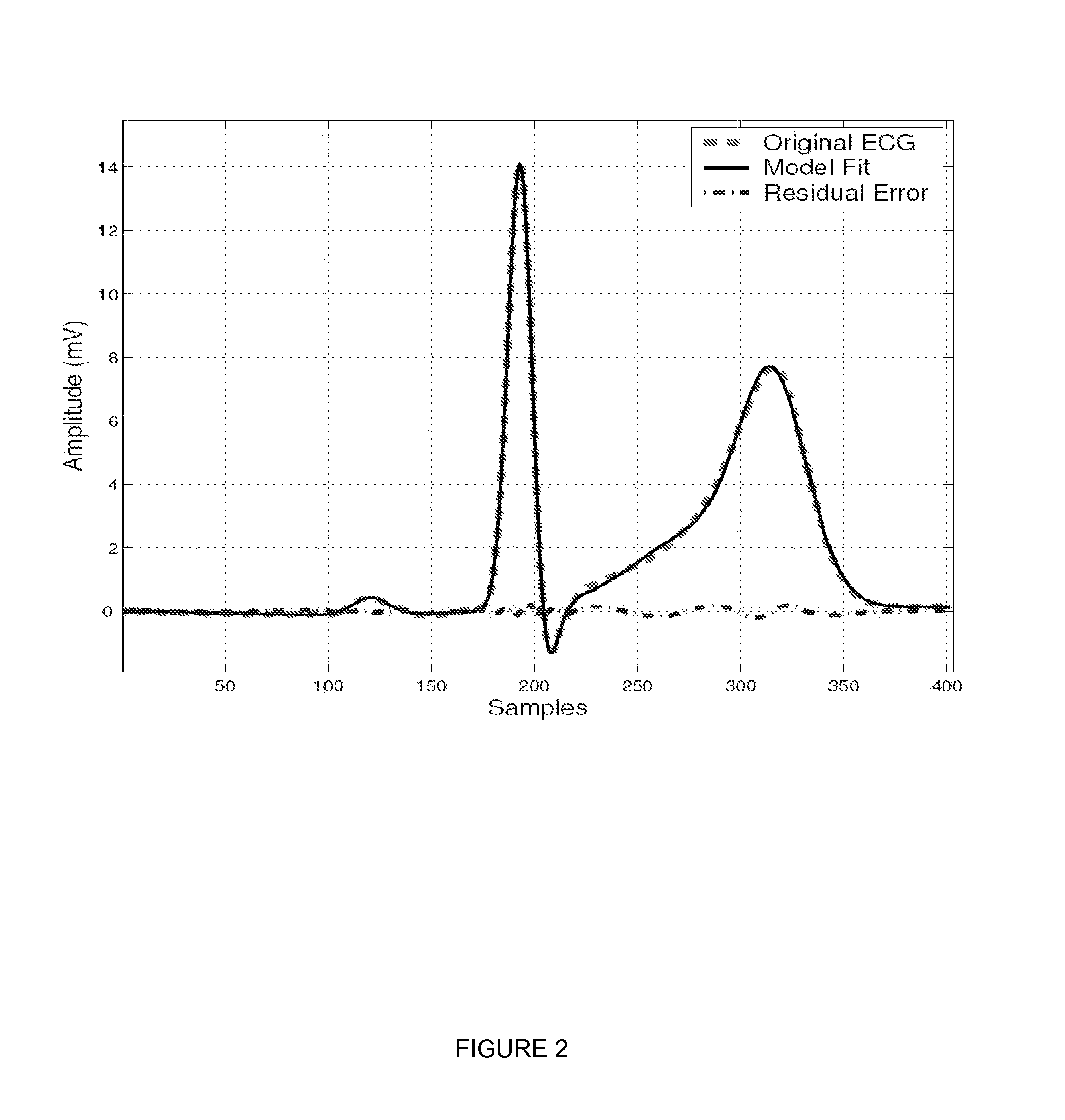 Method and device for filtering, segmenting, compressing and classifying oscillatory signals