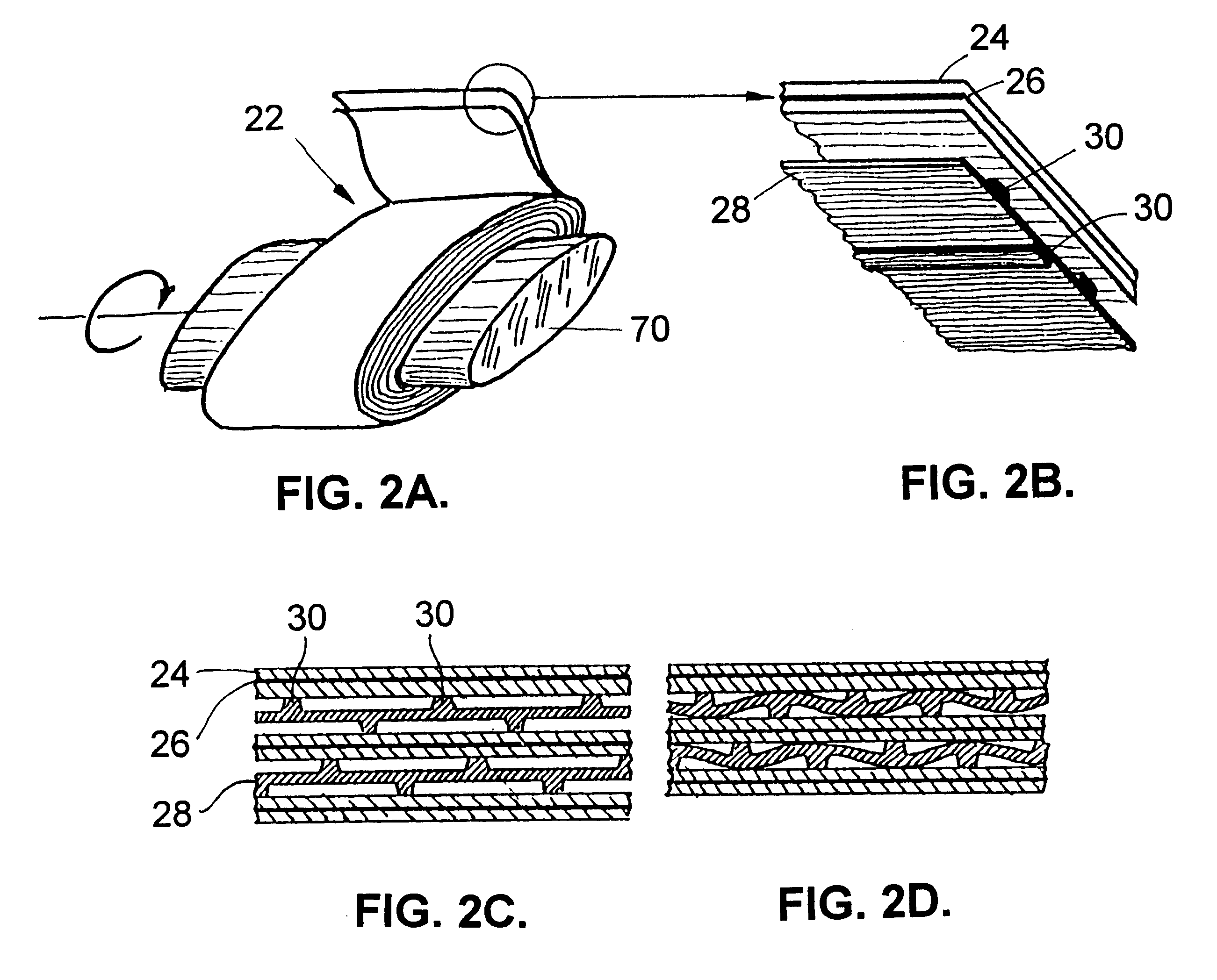 Spiral wound transducer