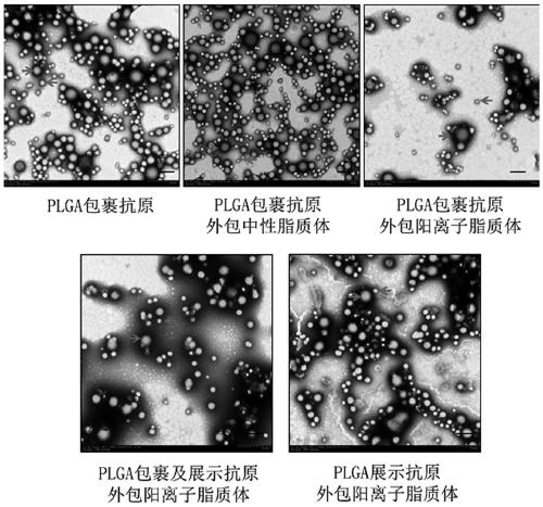 Herpes zoster vaccine composition as well as preparation method and application thereof