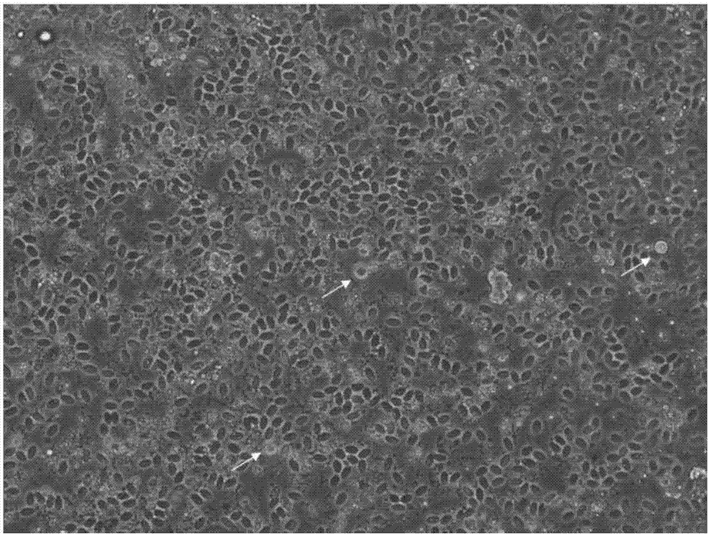 Oocyte separation and extraction method based on duck embryo