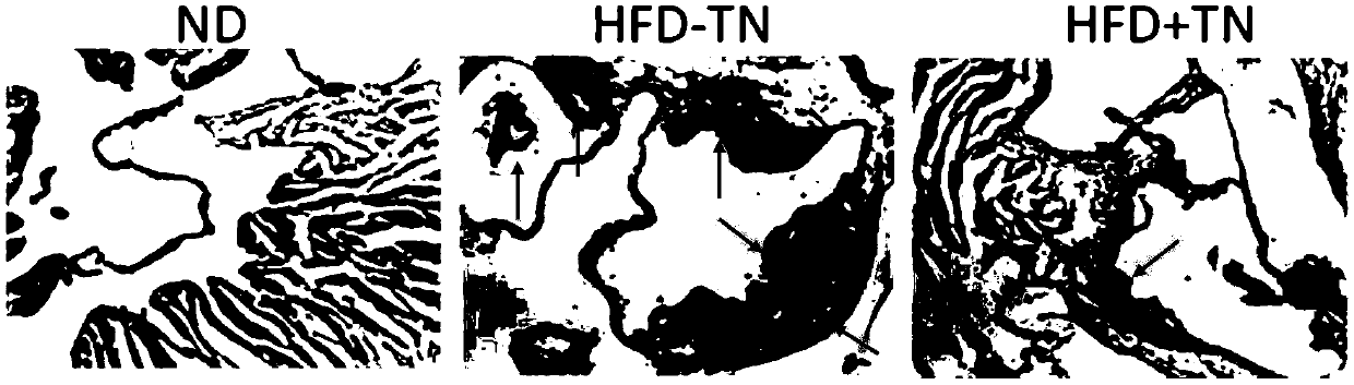 Application of triptonide