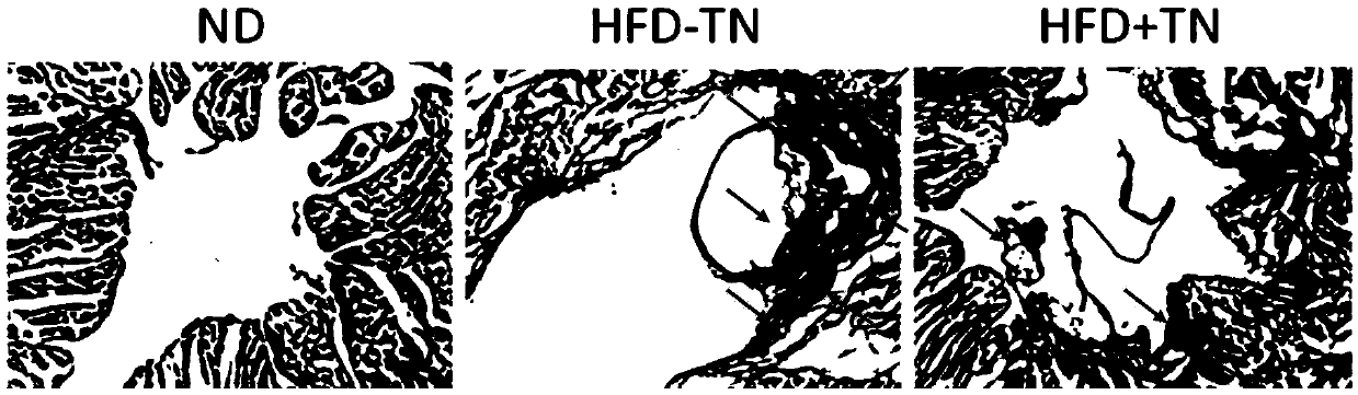 Application of triptonide