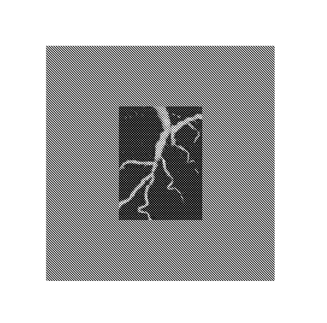 Angiographic image acquisition system and method with automatic shutter adaptation for yielding a reduced field of view covering a segmented target structure or lesion for decreasing X-radiation dose in minimally invasive X-ray-guided interventions