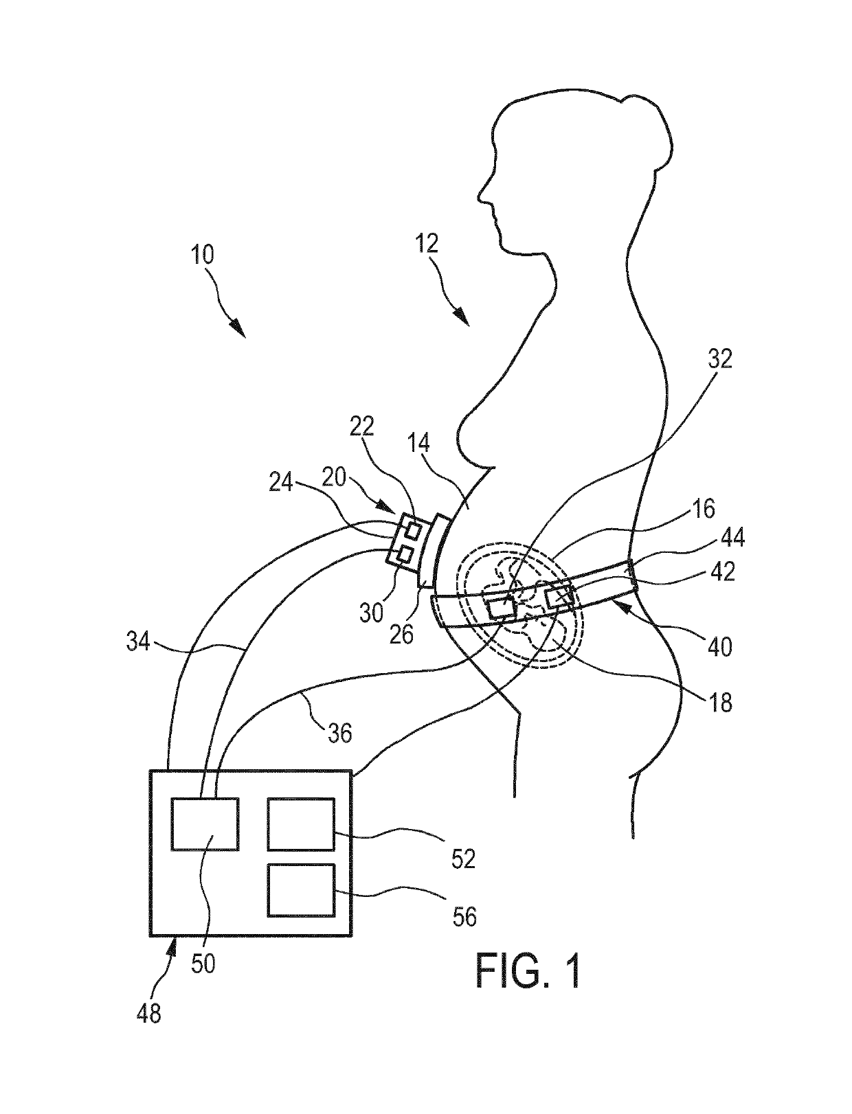 Pregnancy monitoring system and method