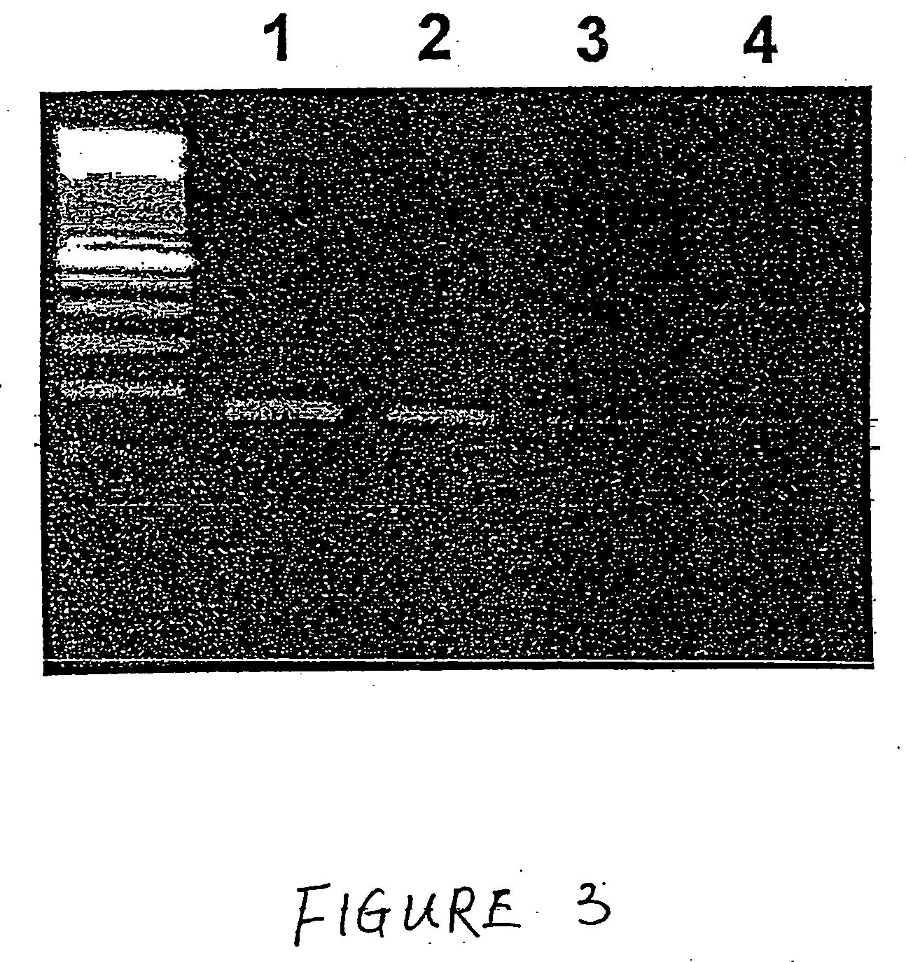 Method for the detection of schizophrenia related gene transcripts in blood