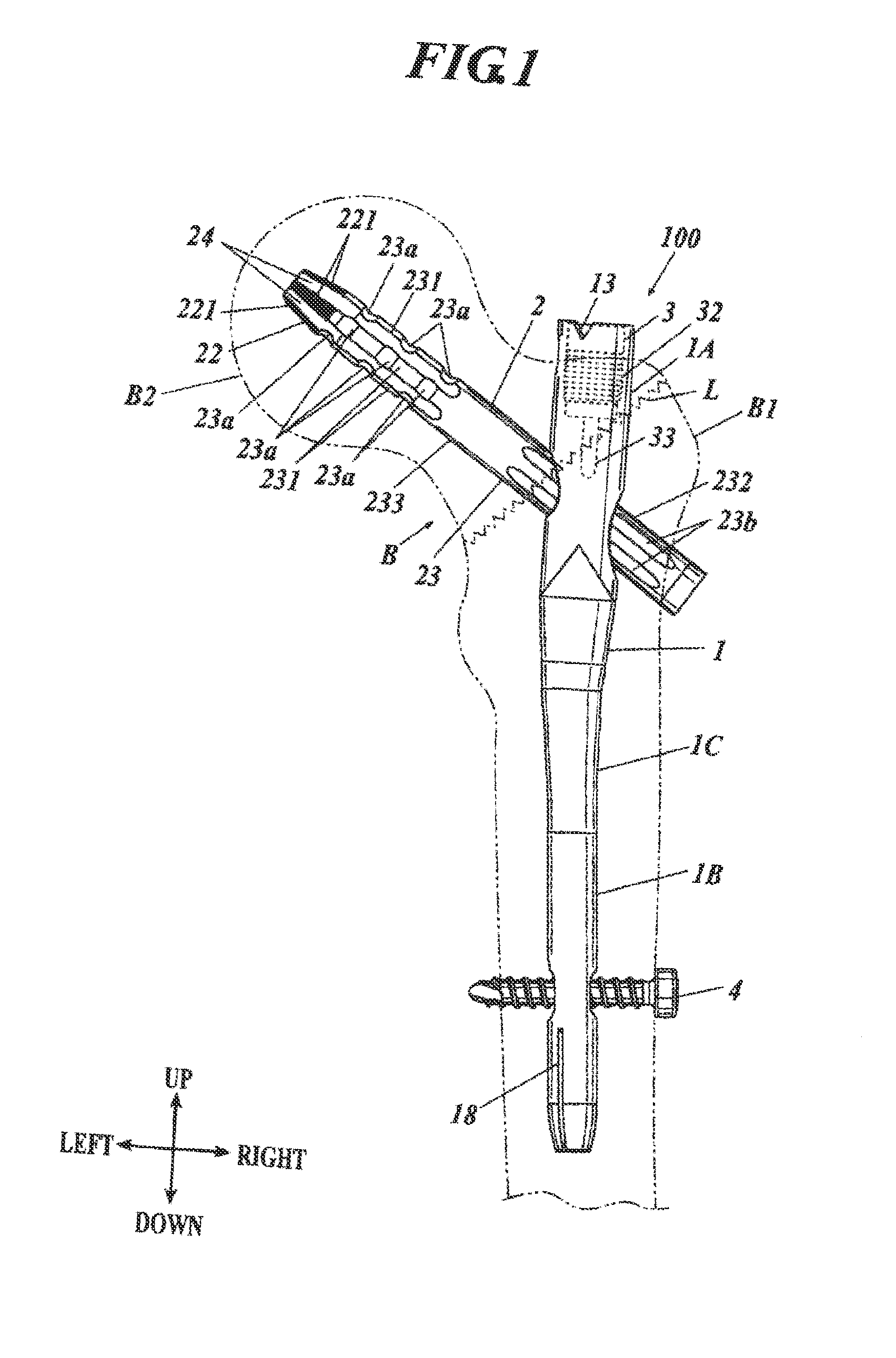 Bone Fixing Material and Thighbone Fixing System