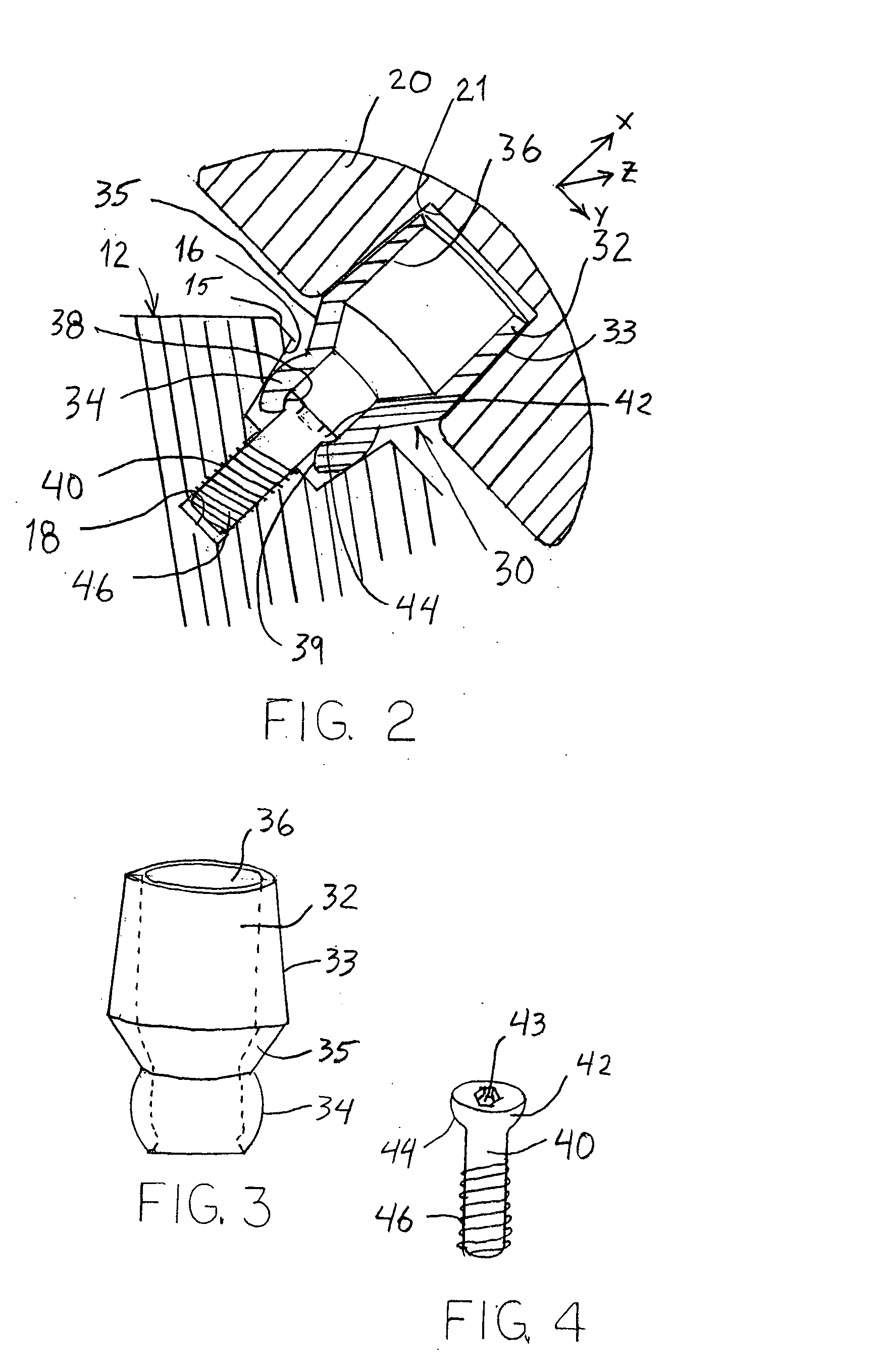 Joint prosthesis with infinitely positionable head