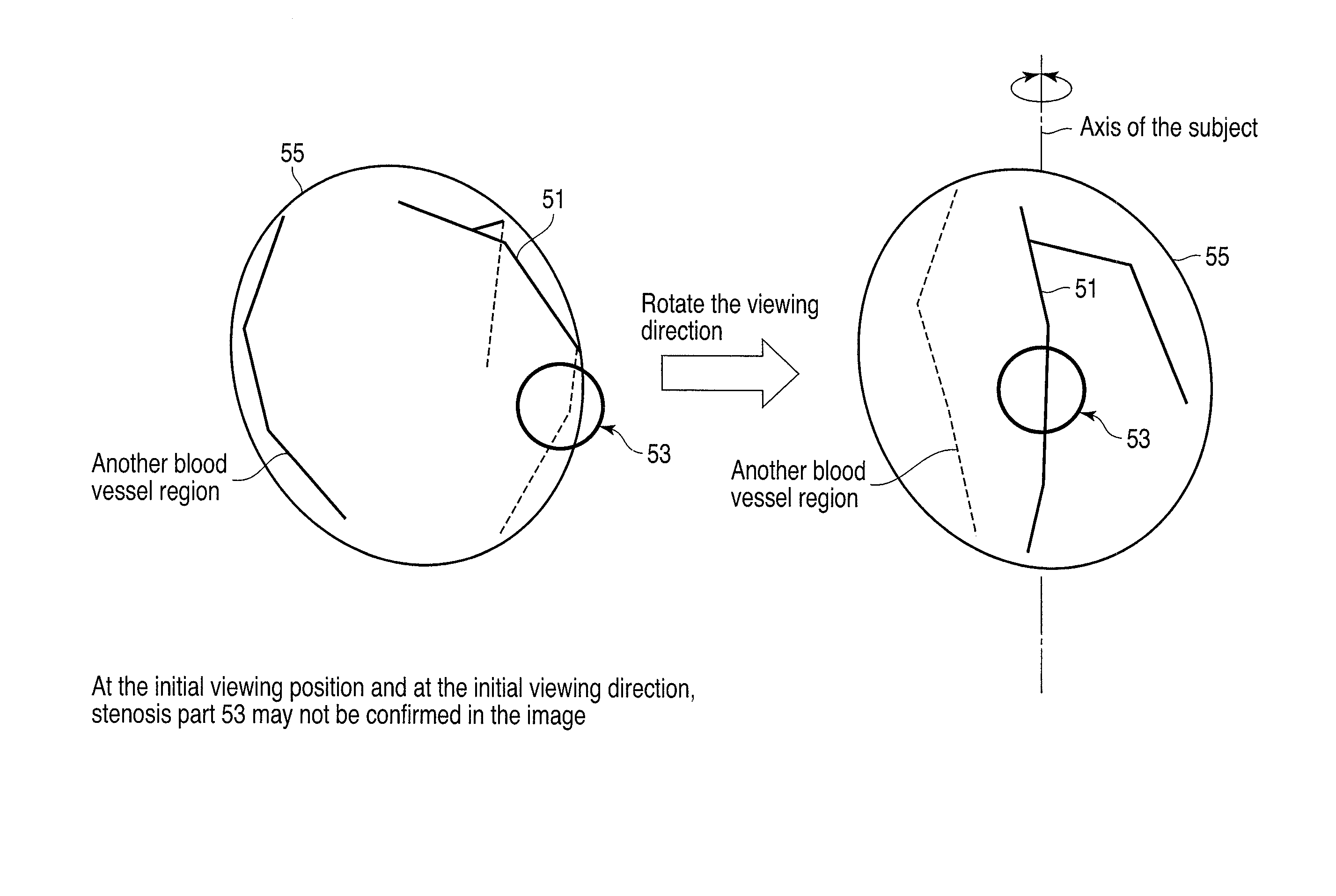 Image processing apparatus and image processing method