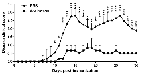 Applications of vorinostat in aspect of drugs for treating autoimmune diseases and inflammatory diseases