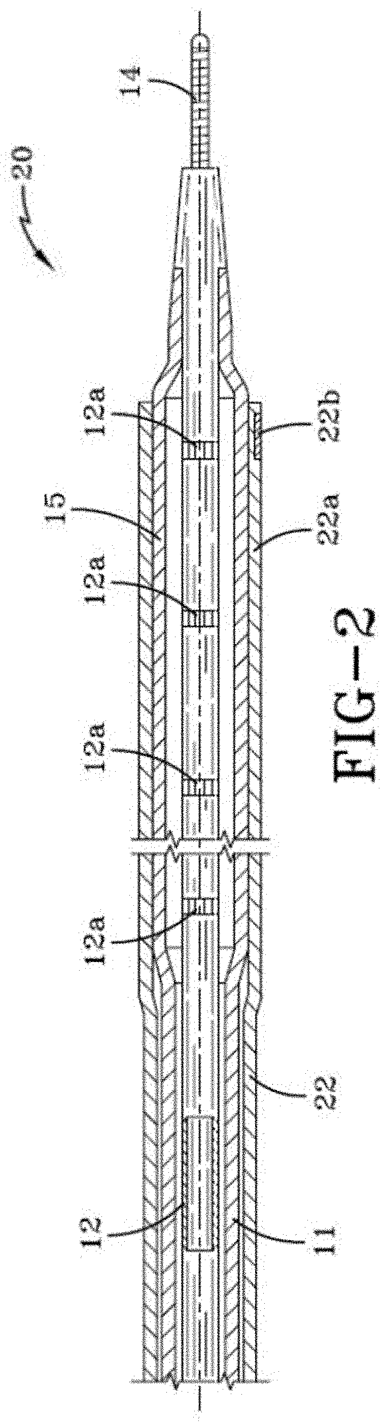 Balloon catheter having a retractable sheath