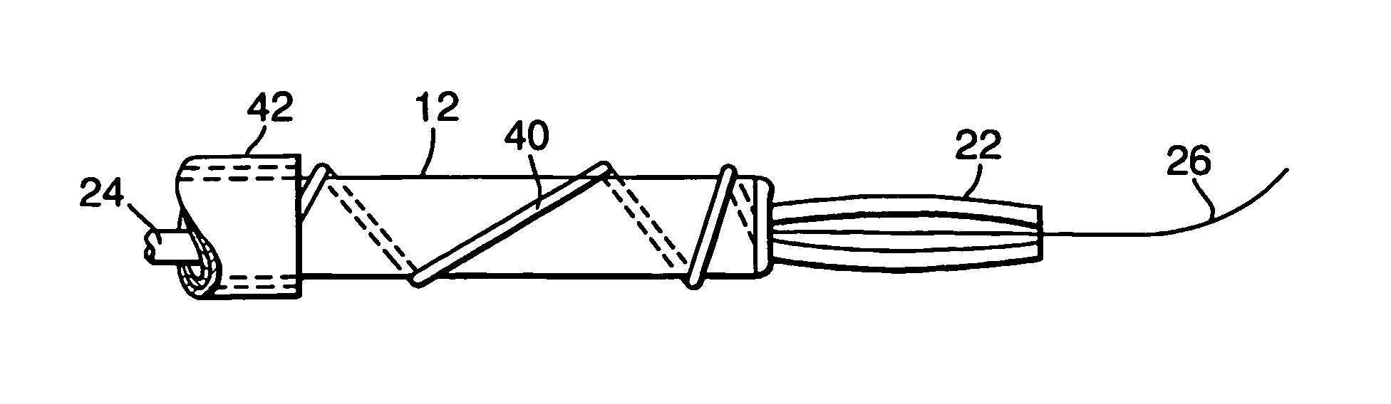 Stent positioning system