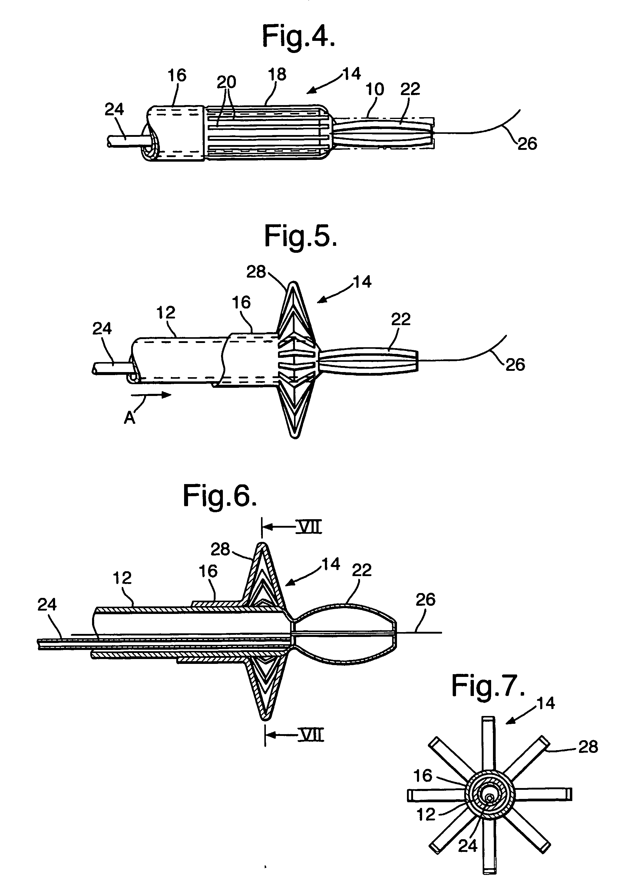 Stent positioning system