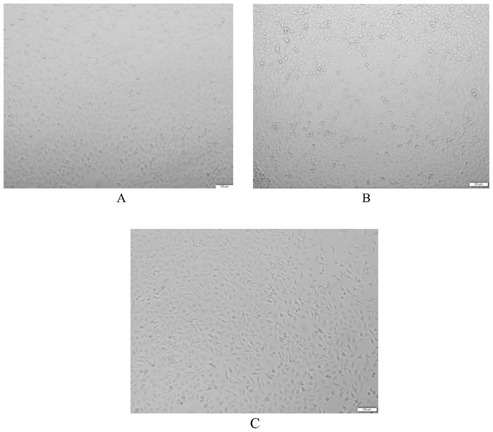 Organic lentinan soluble ball mixture capable of improving intestinal immunity and preparation method thereof