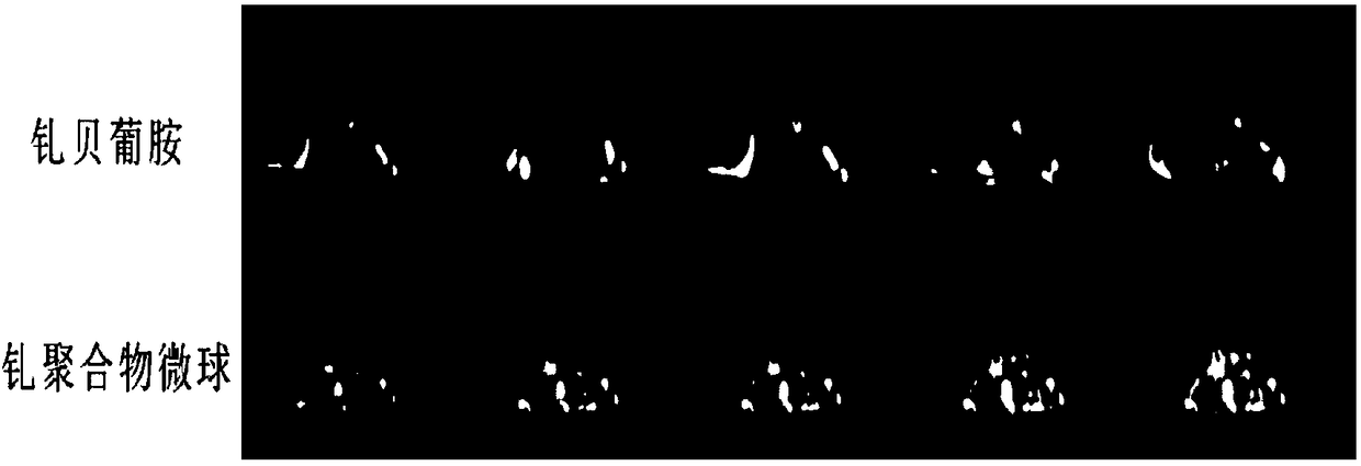 Gadolinium coordination polymer network microsphere and application thereof to magnetic resonance imaging