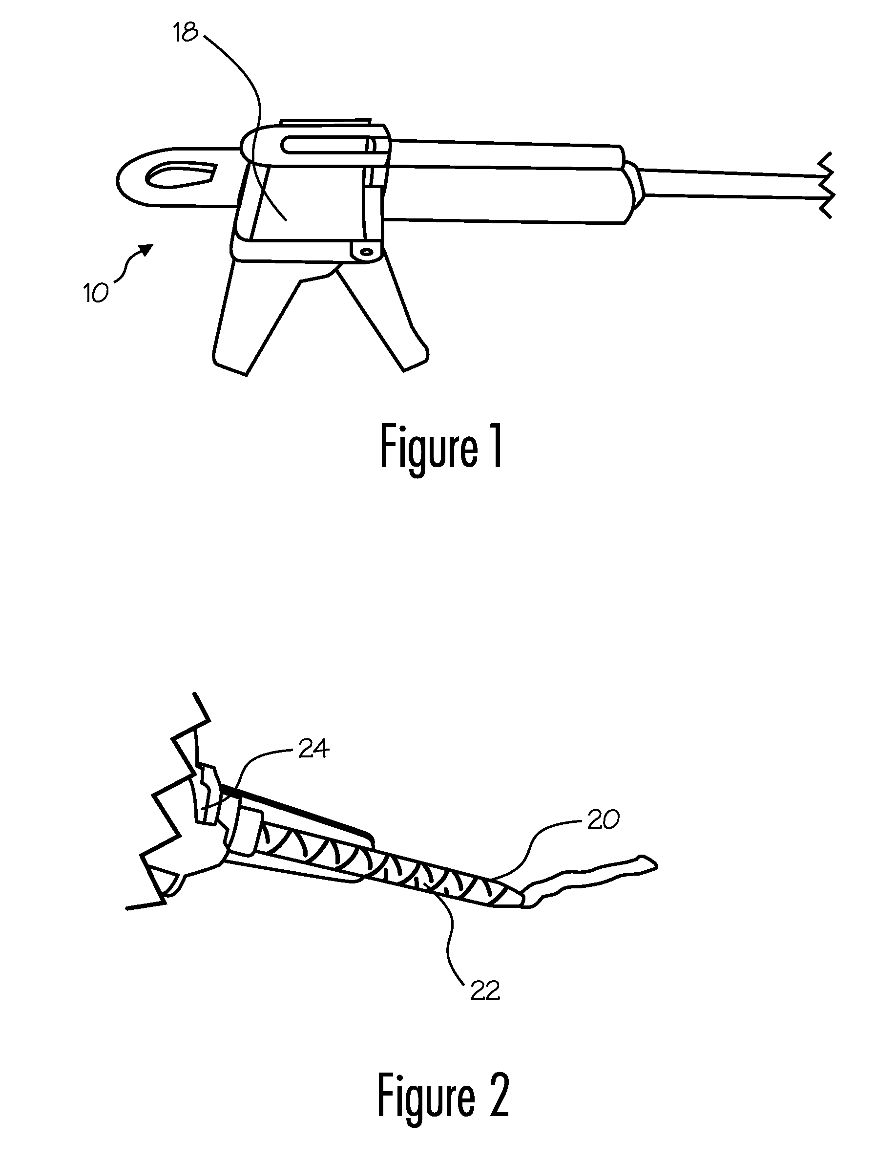 Materials and apparatus for in-situ bone repair