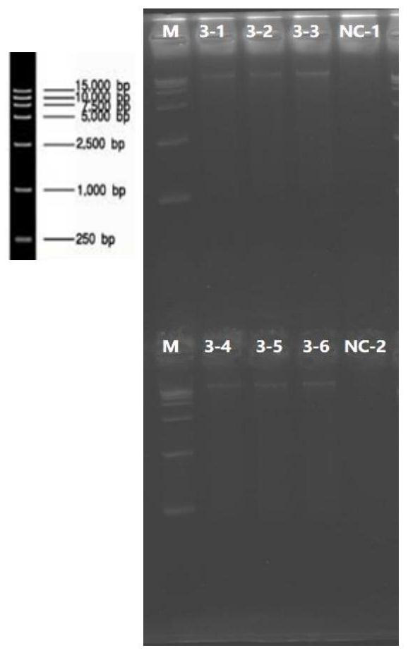 A nucleic acid extraction method and kit