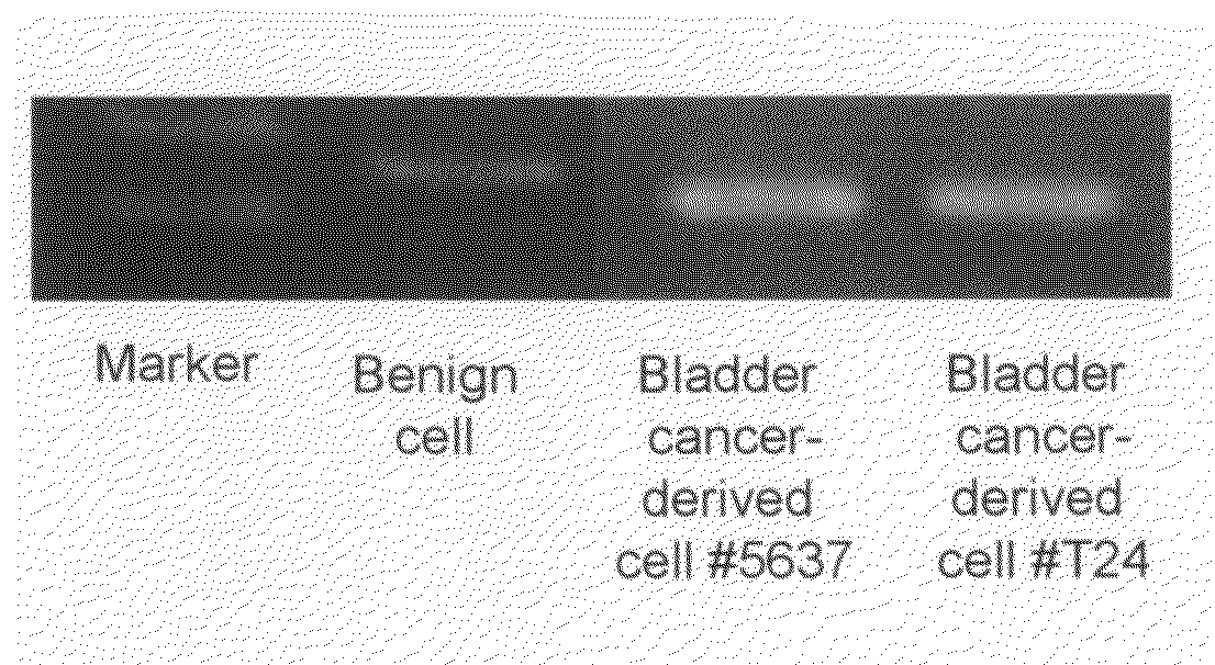 Kit and method for detecting urothelial cancer