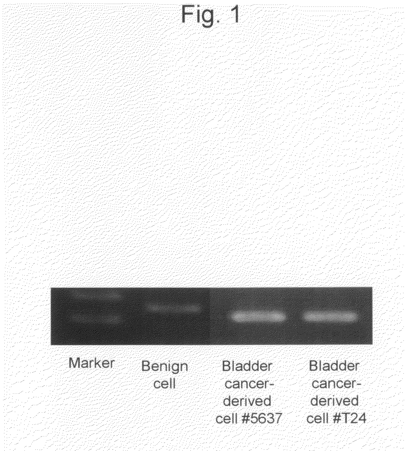 Kit and method for detecting urothelial cancer