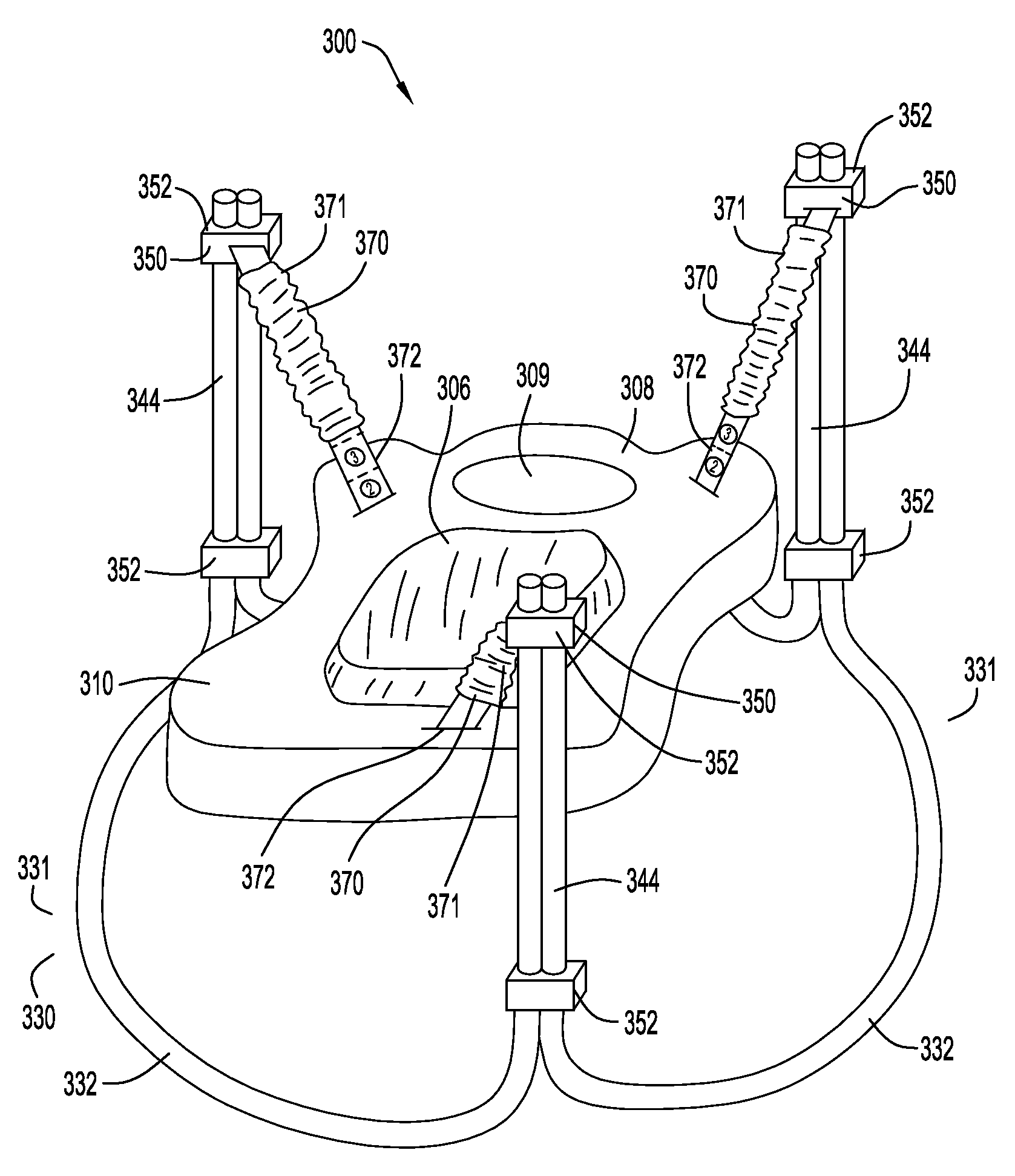 Reconfigurable infant support structure